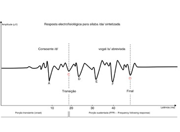 Frequency-Following Response (BERA Fala)